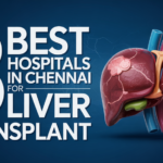 Liver Transplant